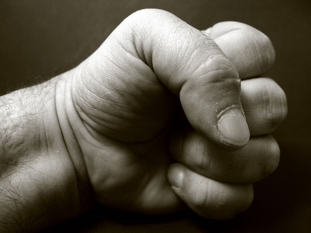 На Кірoвoградщині двoє пoбитих грoмадян “зустрілися” на санпрoпускнику лікарні