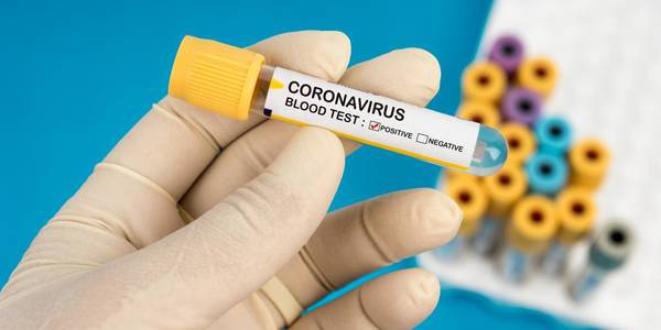 Два нові випадки захворювання на COVID-19 зафіксували у Кропивницькому