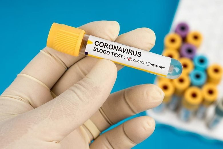 На Кіровоградщині досі відсутні експрес-тести для визначення коронавірусу