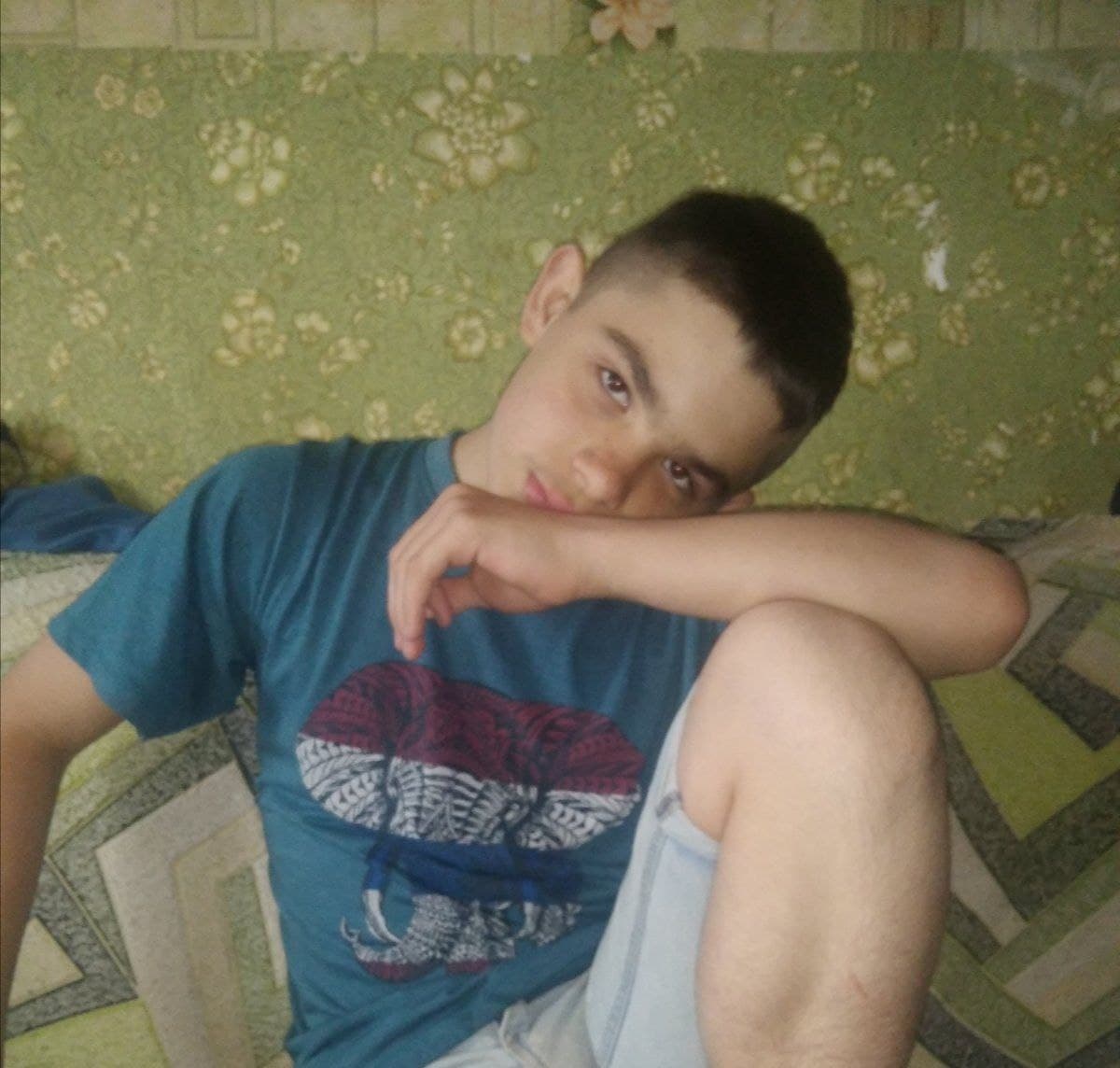 12-річний Юрчик з Кропивницького потребує допомоги, аби жити повноцінно