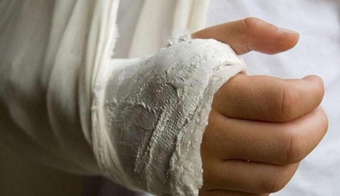 Житель Кіровоградщини металевою трубою зламав руку знайомому