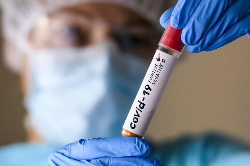 Понад три десятки людей на Кіровоградщині захворіли на коронавірус