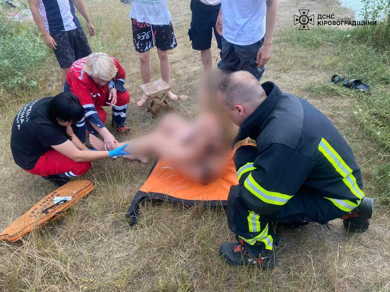 Рятувальники Кіровоградщини допомогли жінці, яка травмувала ногу на пляжі