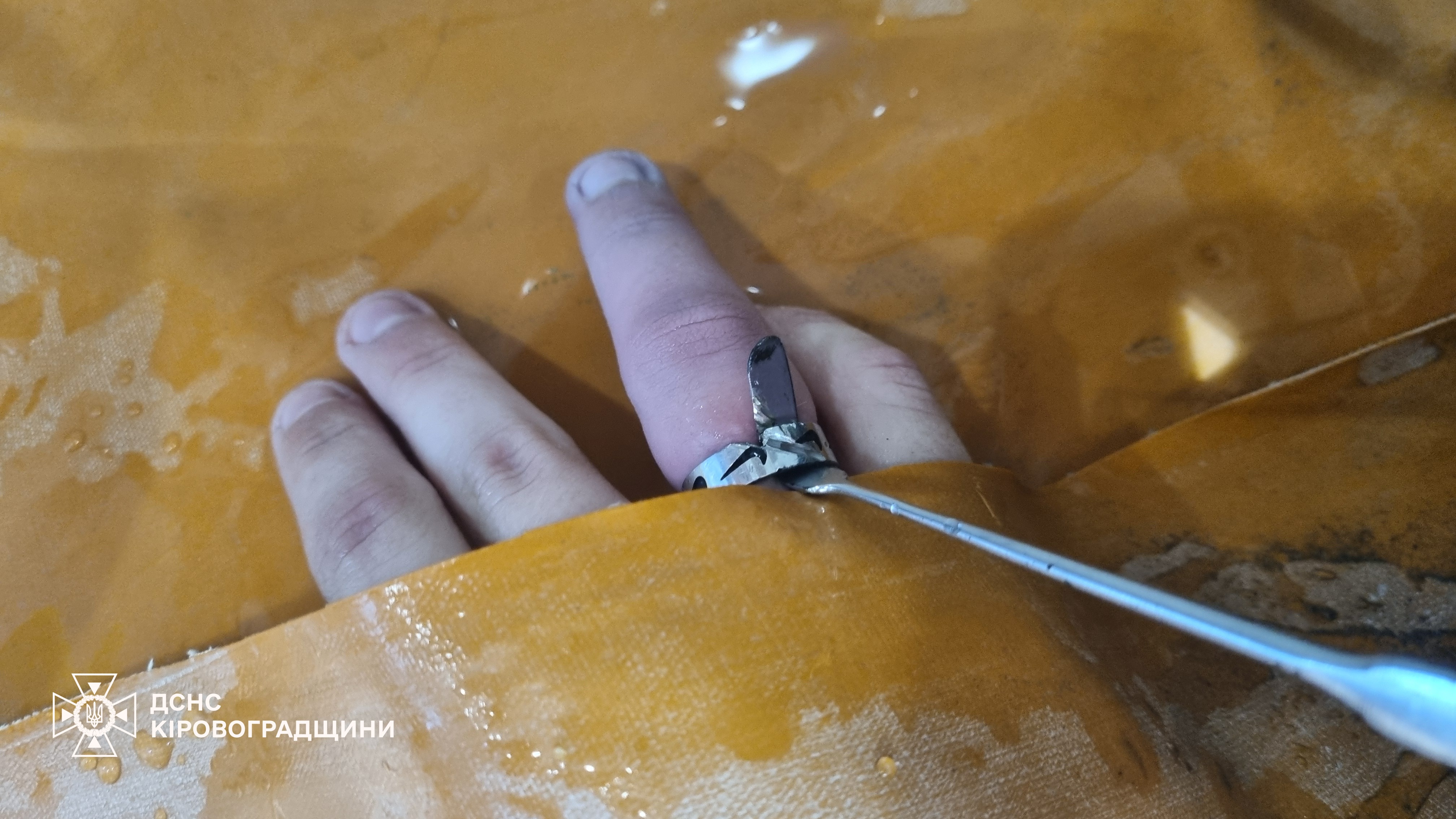Надзвичайники Кiровоградщини допомогли зняти каблучку з пальця