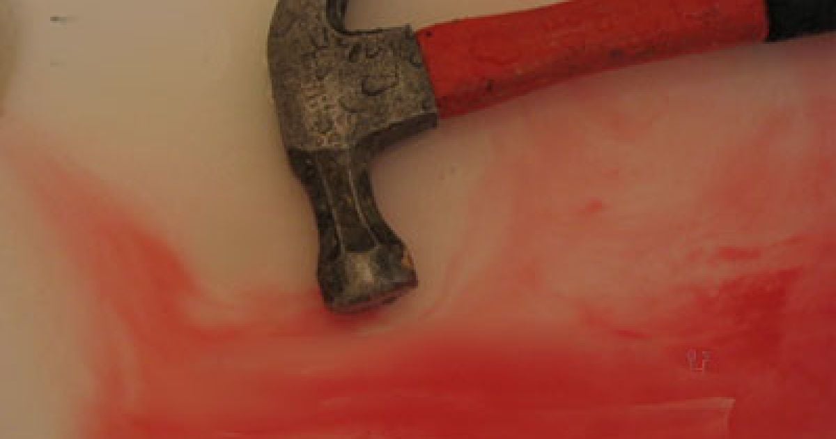 Жителька Кіровоградщини забила чоловіка, який колись ймовірно її зґвалтував